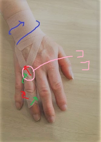 テーピング ばね 中指 指